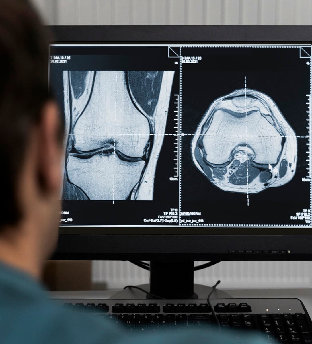 רדיולוג בוחן בדיקת MRI של הברך על צג במרפאה